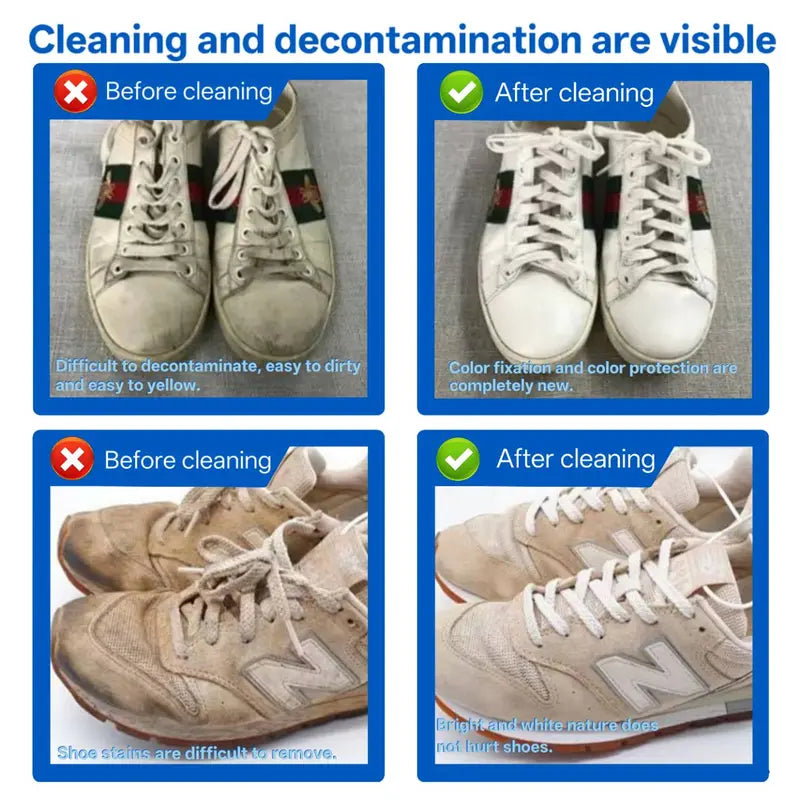 PICKZONE Shoe Cleaner(6.76 oz), Sneaker Cleaner Foam for Removing Stains and Dirt, Shoe Cleaning Solution for White Shoes, Ideal for Footwear, Safe for Leather, Suede, Nubuck, Cotton, Knits,White Shoe Foam Cleaner-PICKZONE