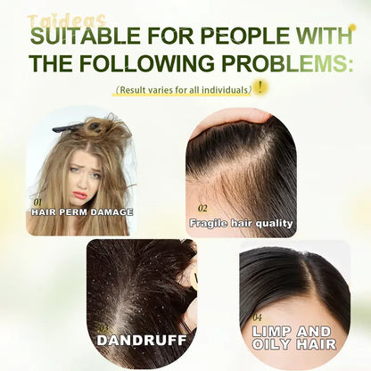 Tgideas Rosemary Amino Acid Shampoo, Buy 1 Get 1 Free – Anti-Hair Loss, Oil Control, Anti-Dandruff with Zinc PCA & Hydrolyzed Silk, Scalp Cleanser 250ml x2